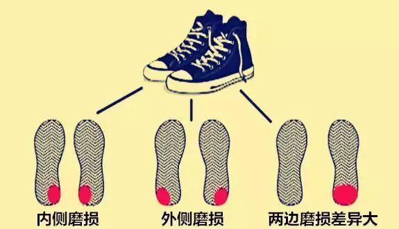 鞋子磨損