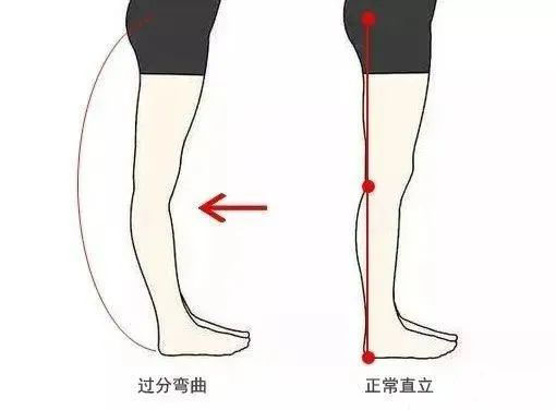 腿站立對比圖