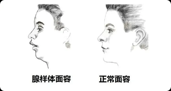 面容對比圖