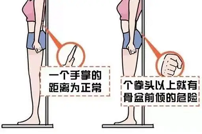 骨盆前傾自測