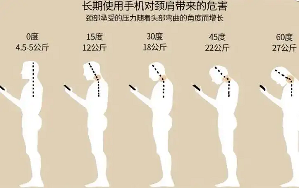 低頭族