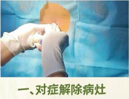 直樂椎間盤五日療法——對(duì)癥解除病灶