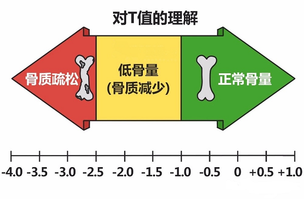 骨密度檢測中T值的理解