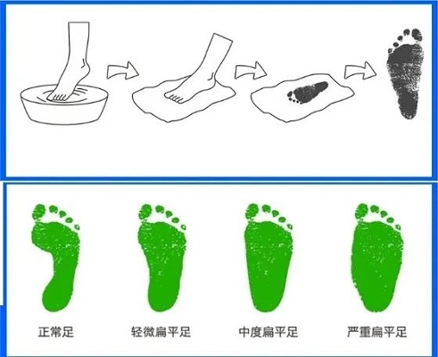 濕足印檢測(cè)方法