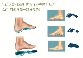 直樂(lè)矯形鞋墊