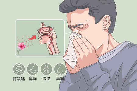 過敏性鼻炎癥狀