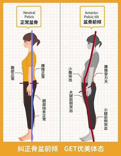 糾正骨盆前傾