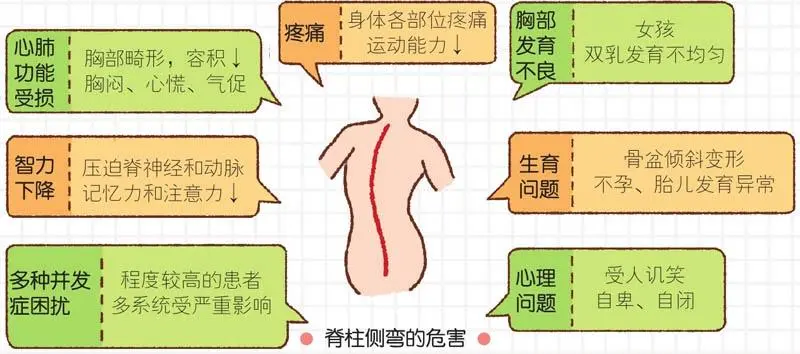 脊柱側(cè)彎危害